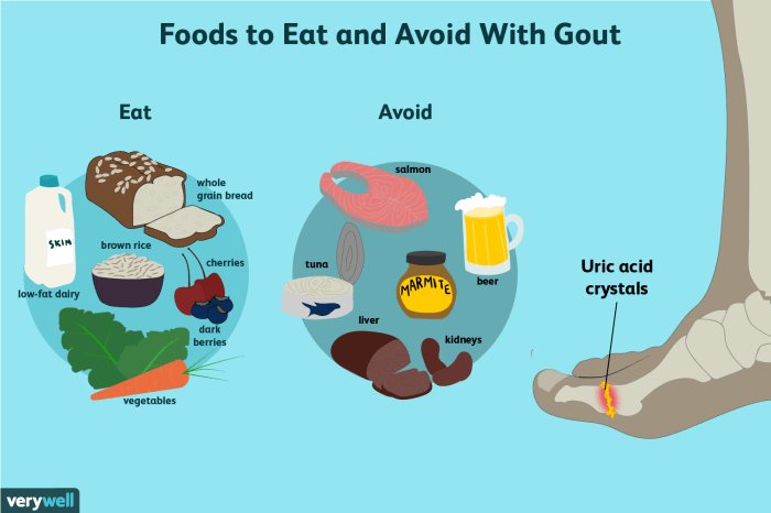 Gicht trotz gesunder ernährung